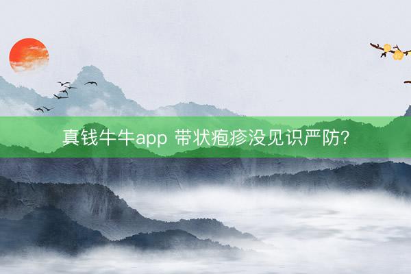 真钱牛牛app 带状疱疹没见识严防？